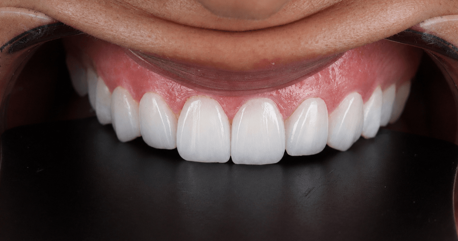 Meilleur Dentiste Casablanca - Cabinet OraSmile